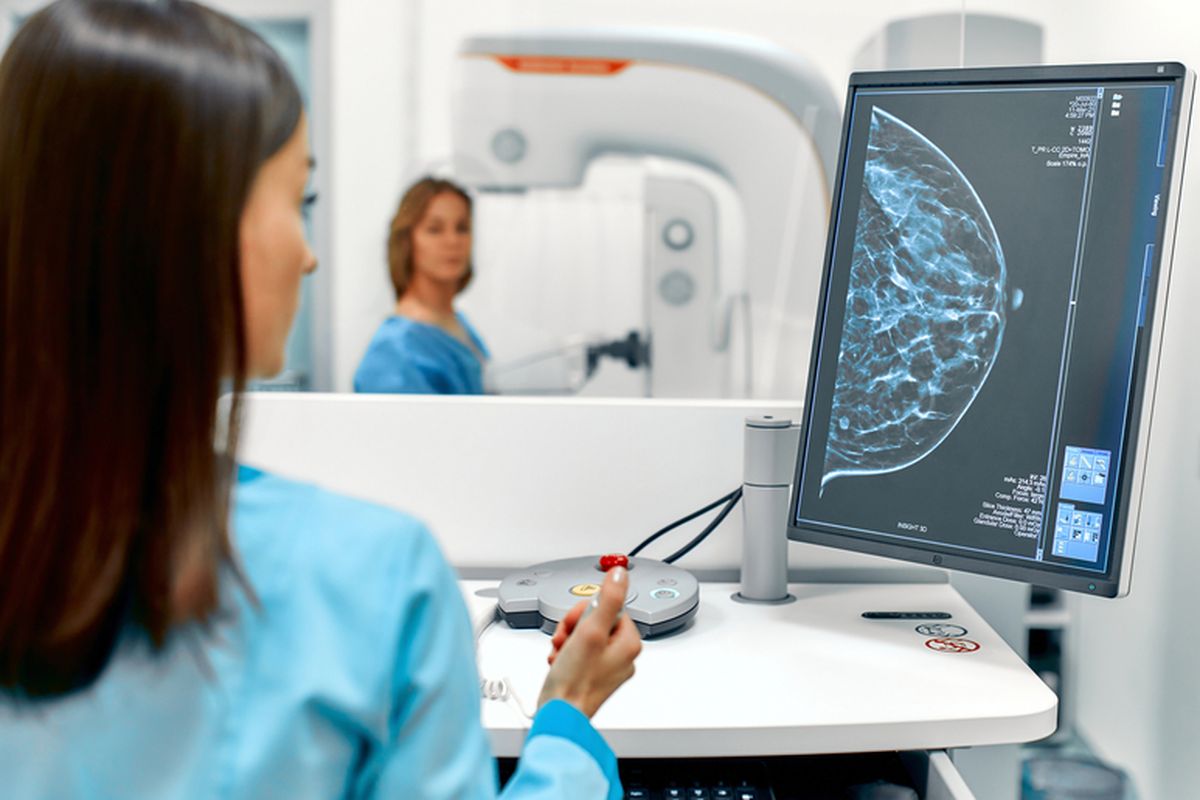Cara Mudah Deteksi Kanker Payudara dengan Mamografi, Mulai di Usia 40 Tahun