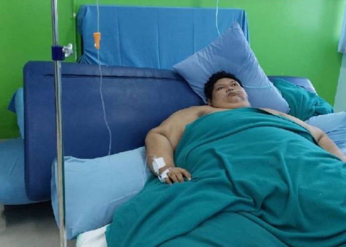 Innalilahi, Fajri Pemuda Obesitas Berbobot 300 kg Meninggal Dunia