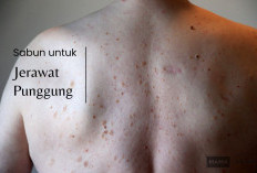 Rekomendasi Sabun Jerawat Punggung yang Ampuh, Atasi Keluhan dan Bisa Dicoba